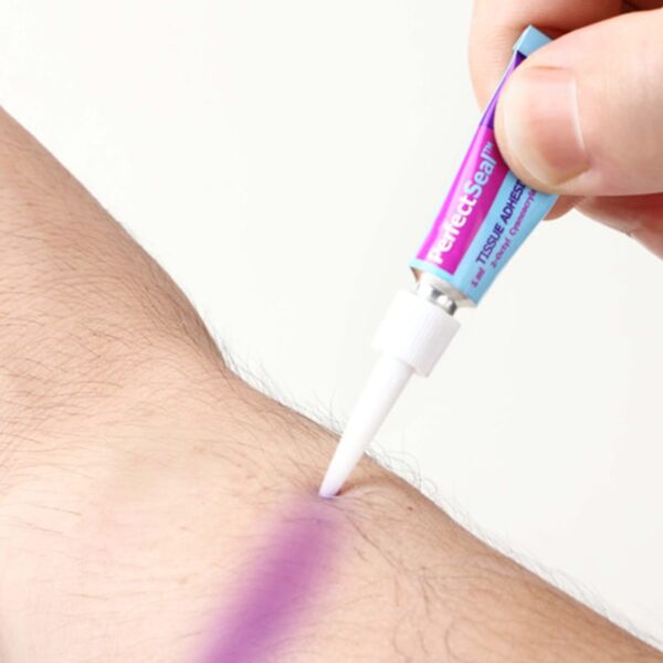 Surgical Glue for Cuts PerfectSeal
