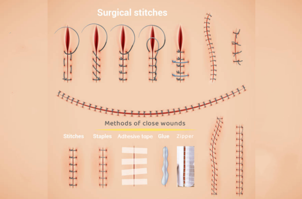 12pcs Cross Stitch Glue Dermabond Surgical Skin Glue Fray Check