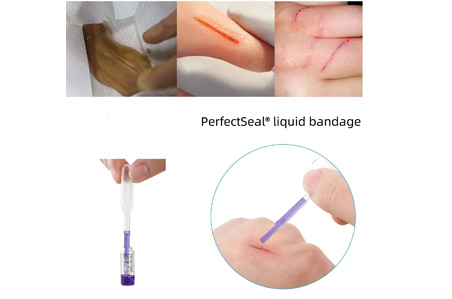 Skin Adhesives (Liquid Stitches)