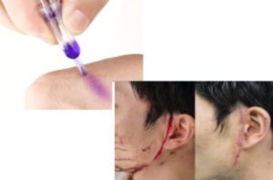 Perfectseal Liquid Stitches Surgical Glue Medical Skin Glue for