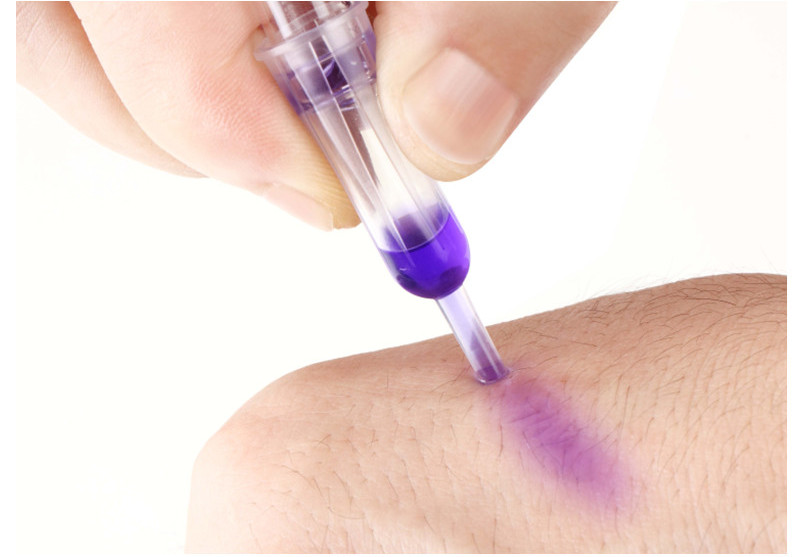 tissue adhesive glue